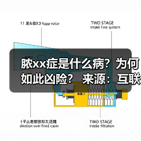 脓xx症是什么病？为何如此凶险？ 来源：互联网 2025-08-22（图4）
