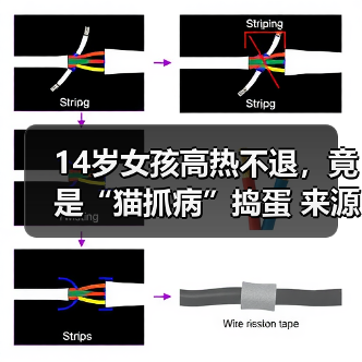 14岁女孩高热不退,竟是“猫抓病”捣蛋 来源:互联网 2025-08-14(图1) 14岁女孩高热不退,竟是“猫抓病”捣蛋 来源:互联网 2025-08-14(图1)