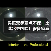 男孩双手差点不保，比沸水更凶险！很多家庭有→