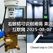 看眼睛可识别肾病 来源：互联网 2025-08-07（图2）