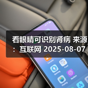 看眼睛可识别肾病 来源：互联网 2025-08-07（图4）