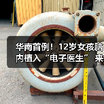 华南首例!12岁女孩脑内植入“电子医生” 来源:互联网 2025-09-09(图3) 华南首例!12岁女孩脑内植入“电子医生” 来源:互联网 2025-09-09(图3)